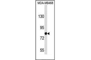 Image no. 1 for anti-Ecotropic Viral Integration Site 5 (EVI5) (AA 230-259), (Middle Region) antibody (ABIN952136)