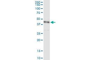 Image no. 1 for anti-serine/threonine Kinase 19 (STK19) (AA 1-364) antibody (ABIN522324)