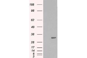 Image no. 1 for anti-Syntaxin 6 (STX6) (Internal Region) antibody (ABIN185614)