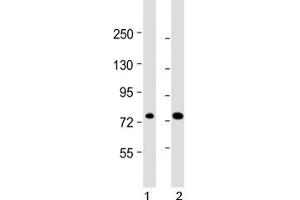 Image no. 1 for anti-ATP-Binding Cassette, Sub-Family D (Ald), Member 1 (ABCD1) (AA 257-285) antibody (ABIN5647318)