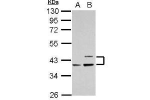 Image no. 2 for anti-Apolipoprotein L, 1 (APOL1) (Center) antibody (ABIN2856391)