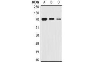 Image no. 1 for anti-Solute Carrier Family 20 (Phosphate Transporter), Member 2 (SLC20A2) antibody (ABIN2966913)