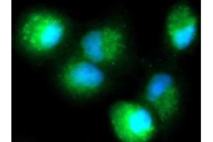 Image no. 1 for anti-Dual Specificity Phosphatase 18 (DUSP18) (AA 1-188) antibody (FITC) (ABIN5565391)