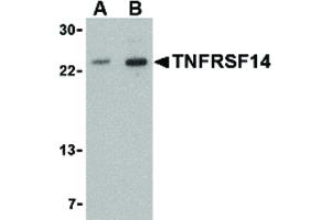 HVEM antibody  (N-Term)