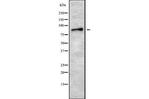 Image no. 2 for anti-ADAM Metallopeptidase Domain 8 (ADAM8) antibody (ABIN6259775)