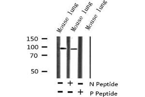 Image no. 5 for anti-Tumor Protein P73 (TP73) (pTyr99) antibody (ABIN6256817)
