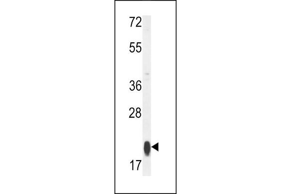 MRPS25 antibody  (C-Term)