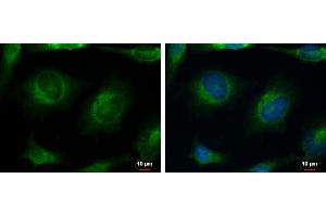 ICC/IF Image CACNB4 antibody [C3], C-term detects CACNB4 protein at cytoplasm by immunofluorescent analysis.