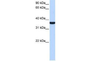 Image no. 1 for anti-Tumor Protein P53 Inducible Protein 13 (TP53I13) (C-Term) antibody (ABIN928567)