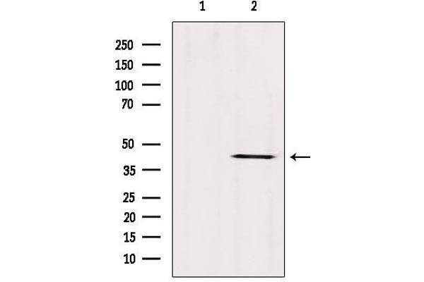 anti-Abhydrolase Domain Containing 13 (ABHD13) (Internal Region) antibody