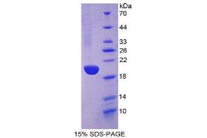 Image no. 1 for Keratin 13 (KRT13) (AA 266-404) protein (His tag,T7 tag) (ABIN1981017)