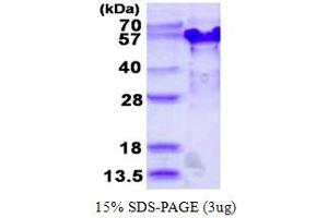 Image no. 1 for Tumor Suppressing Subtransferable Candidate 4 (TSSC4) (AA 1-329) protein (His tag) (ABIN668006)