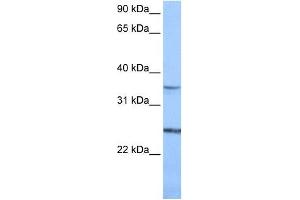 Image no. 1 for anti-Phosphatidylinositol Glycan F (PIGF) (N-Term) antibody (ABIN635684)