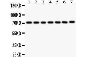 Image no. 3 for anti-Forkhead Box O3 (FOXO3) (AA 471-673) antibody (ABIN3042404)