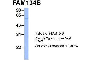 Image no. 2 for anti-Family with Sequence Similarity 134, Member B (FAM134B) (Middle Region) antibody (ABIN2782025)
