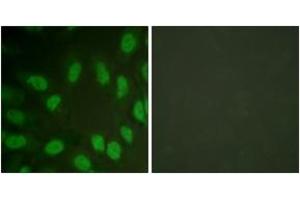 Image no. 3 for anti-Runt-Related Transcription Factor 1 (RUNX1) (AA 269-318) antibody (ABIN1532276)
