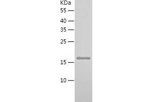 Calcineurin B Protein (CAN) (AA 1-170) (His tag)