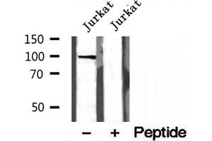 Image no. 3 for anti-Nucleotide-Binding Oligomerization Domain Containing 2 (NOD2) antibody (ABIN6263679)