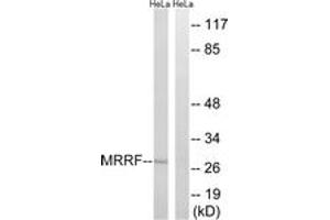 Image no. 1 for anti-Mitochondrial Ribosome Recycling Factor (MRRF) (AA 181-230) antibody (ABIN1535311)