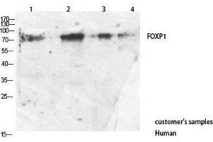 Image no. 1 for anti-Forkhead Box P1 (FOXP1) (C-Term) antibody (ABIN3187748)