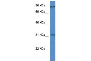 Image no. 1 for anti-Midline 2 (MID2) (N-Term) antibody (ABIN2775977)