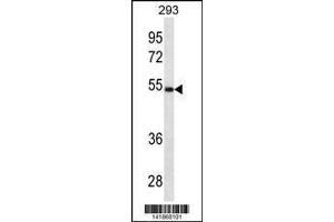 Image no. 1 for anti-Legumain (LGMN) (AA 83-112), (N-Term) antibody (ABIN1881495)
