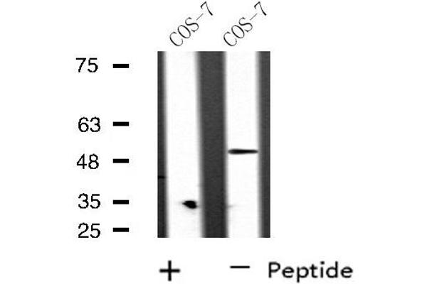 anti-DNA Repair Protein RAD51 Homolog 3 (RAD51C) (Internal Region) antibody