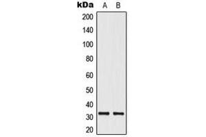 Image no. 1 for anti-ELOVL Fatty Acid Elongase 1 (ELOVL1) (Center) antibody (ABIN2706091)