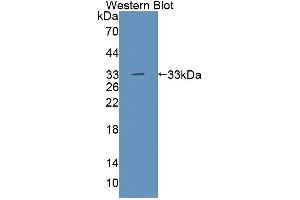 Tec Protein Tyrosine Kinase (TEC) (AA 369-622) antibody