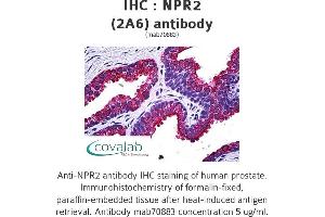 Image no. 1 for anti-Natriuretic Peptide Receptor B/guanylate Cyclase B (Atrionatriuretic Peptide Receptor B) (NPR2) (AA 131-231) antibody (ABIN1723732)