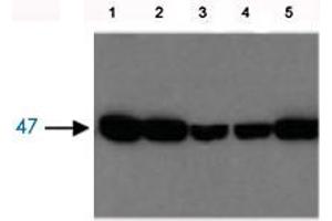 Image no. 1 for anti-Fumarylacetoacetate Hydrolase (Fumarylacetoacetase) (FAH) antibody (ABIN541084)