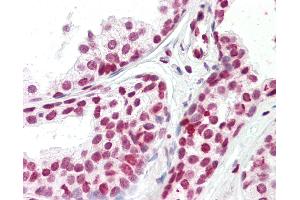 Anti-FOXH1 antibody IHC staining of human prostate.