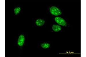 Image no. 2 for anti-Mesenchyme Homeobox 1 (MEOX1) (AA 165-252) antibody (ABIN517872)