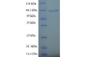 Image no. 1 for Phospholipase D4 (PLD4) (AA 52-506), (partial) protein (His-SUMO Tag) (ABIN5711579)