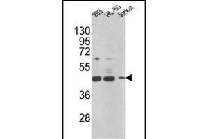 HSD17B7 Antikörper  (N-Term)