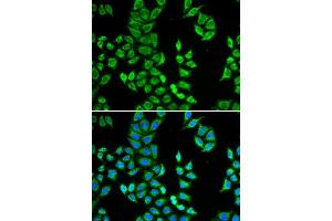 Image no. 1 for anti-Amyloid P Component, Serum (APCS) antibody (ABIN3022714)