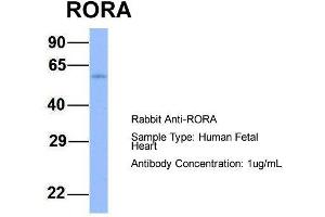Image no. 1 for anti-RAR-Related Orphan Receptor A (RORA) (N-Term) antibody (ABIN2782303)
