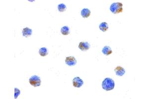 Image no. 3 for anti-BCL2-Interacting Killer (Apoptosis-Inducing) (BIK) (N-Term) antibody (ABIN6655841)
