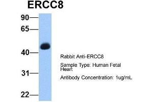 ERCC8 antibody  (C-Term)