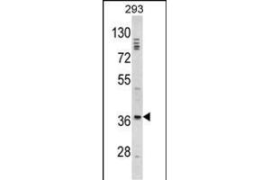 DLX2 antibody  (AA 194-222)