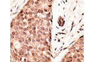 Image no. 5 for anti-Caudal Type Homeobox 2 (CDX2) (AA 1-30) antibody (ABIN3030336)
