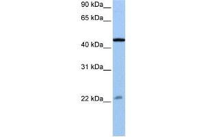 Image no. 2 for anti-Ewing Sarcoma Breakpoint Region 1 (EWSR1) (N-Term) antibody (ABIN2779046)