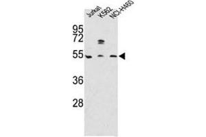 Image no. 3 for anti-Apolipoprotein A-IV (APOA4) (AA 49-79) antibody (ABIN3029992)