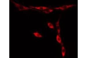 Image no. 3 for anti-Parkinson Protein 7 (PARK7) (C-Term) antibody (ABIN6264038)