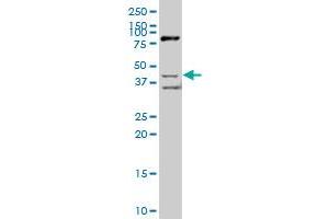 Image no. 1 for anti-Src Kinase Associated Phosphoprotein 2 (SKAP2) (AA 1-359) antibody (ABIN563886)