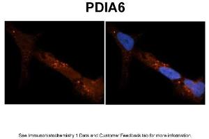 Image no. 3 for anti-Protein Disulfide Isomerase Family A, Member 6 (PDIA6) (N-Term) antibody (ABIN2784775)
