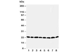 Image no. 1 for anti-Peroxiredoxin 5 (PRDX5) (C-Term) antibody (ABIN3032191)