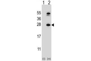 Image no. 4 for anti-Dihydrofolate Reductase (DHFR) (AA 135-164) antibody (ABIN3030729)