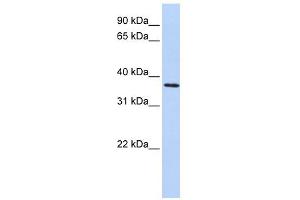 Image no. 1 for anti-F-Box Protein 8 (FBXO8) (Middle Region) antibody (ABIN631700)