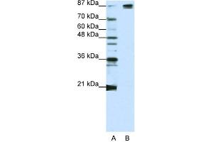 Image no. 1 for anti-Splicing Factor 3b, Subunit 1, 155kDa (SF3B1) (Middle Region) antibody (ABIN2778699)